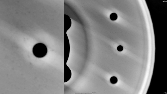 Mini-focus CT result